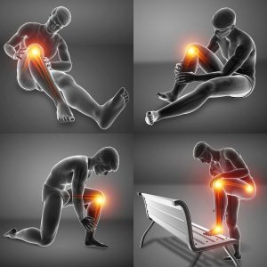 Gelenkschmerzen, Knieschmerzen